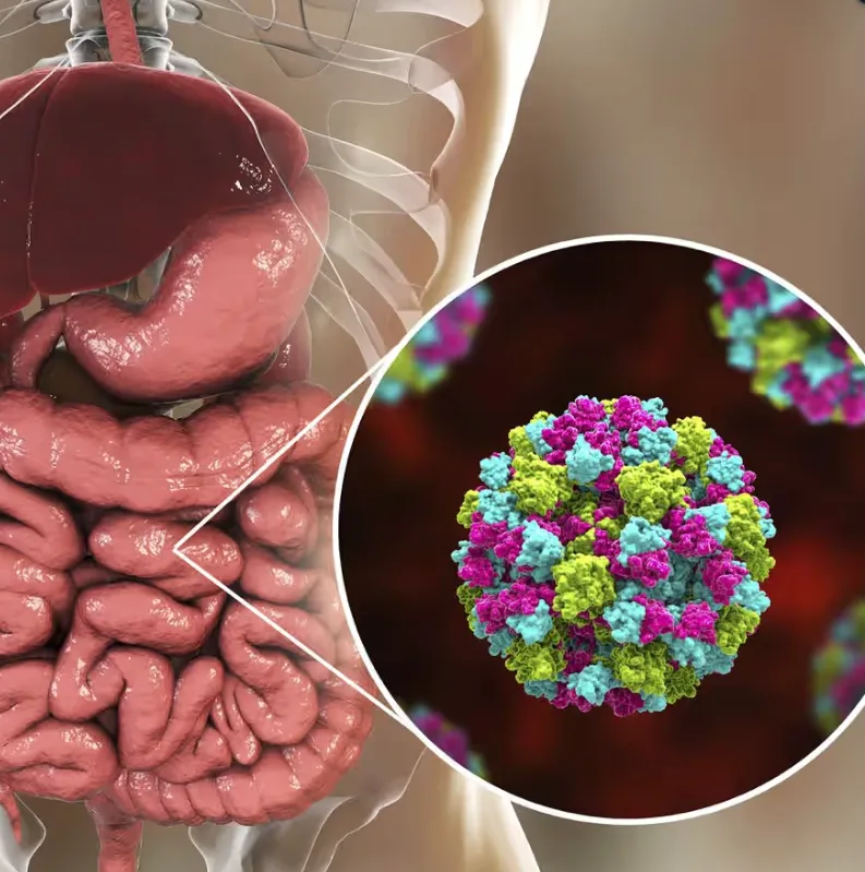 Can You Have Norovirus Without Vomiting Can You Have Norovirus Without Vomiting